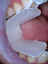 Load image into Gallery viewer, NU-BLOCK - 100 Disposable Mouth Props