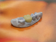 Load image into Gallery viewer, Temp Tray - Disposable Impression Trays (100ct)
