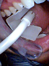 Load image into Gallery viewer, NU-BLOCK - 100 Disposable Mouth Props
